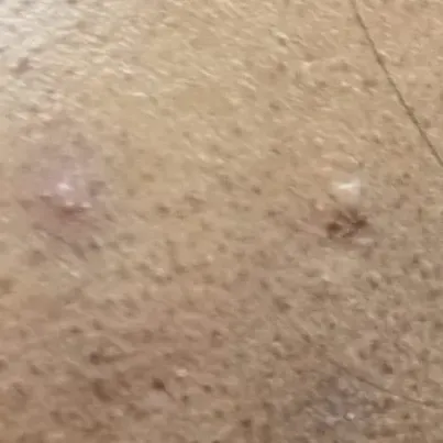 Vibha skin, hair and laser cli
