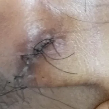 Vibha skin, hair and laser cli