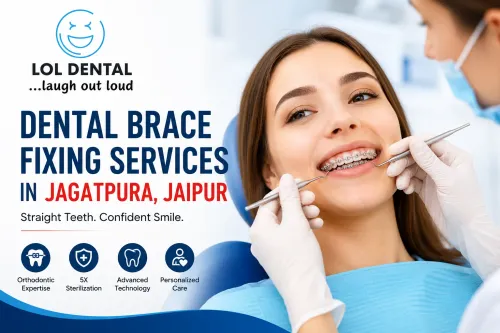 Dental Brace Fixing Services i