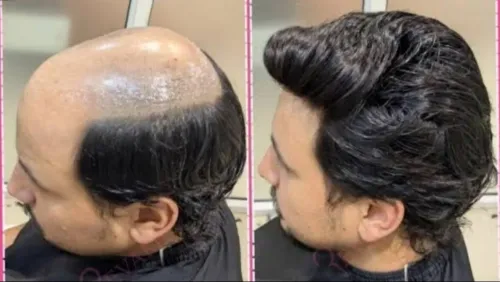 Looking for a permanent hair p