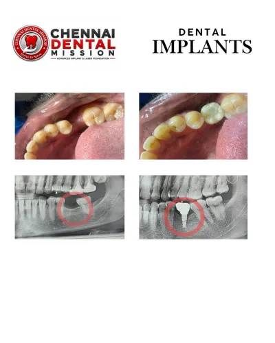 update image