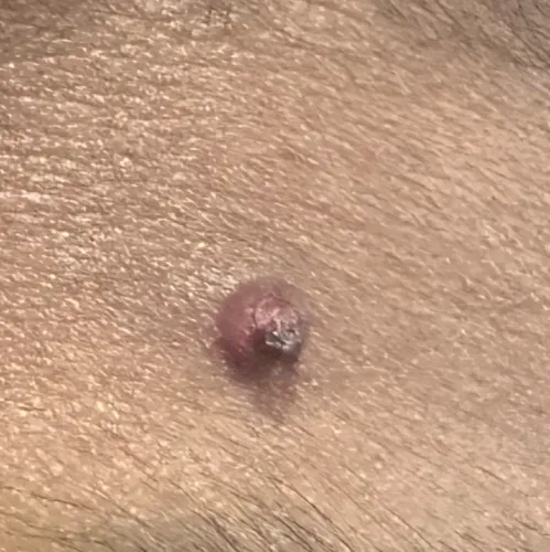 Vibha skin, hair and laser cli
