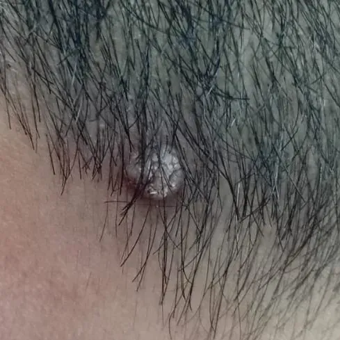 Vibha skin, hair and laser cli