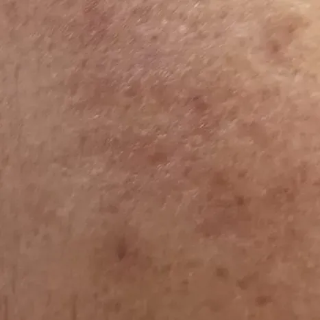 Vibha skin, hair and laser cli