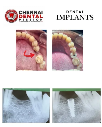 update image