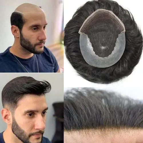 Best Hair patch in Rohini Best