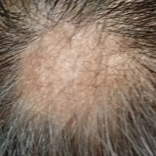 Vibha skin, hair and laser cli