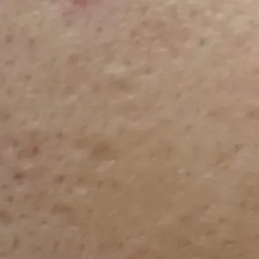 Vibha skin, hair and laser cli
