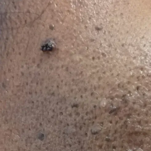 Vibha skin, hair and laser cli