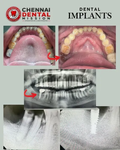 update image