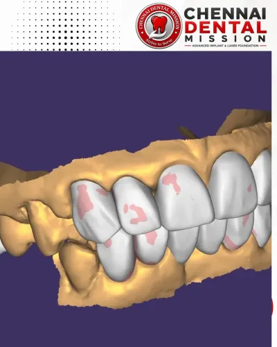 update image