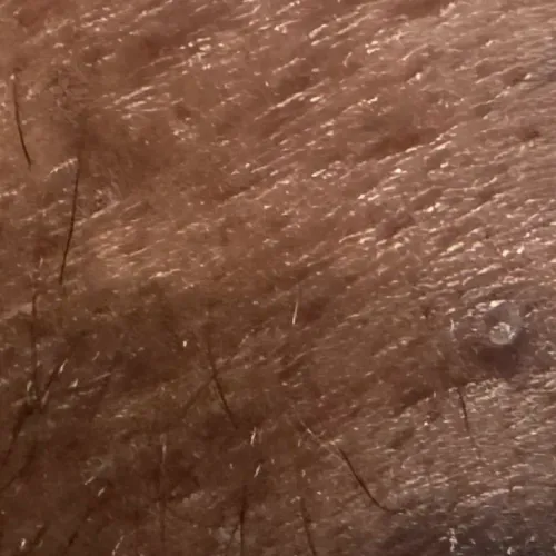 Vibha skin, hair and laser cli