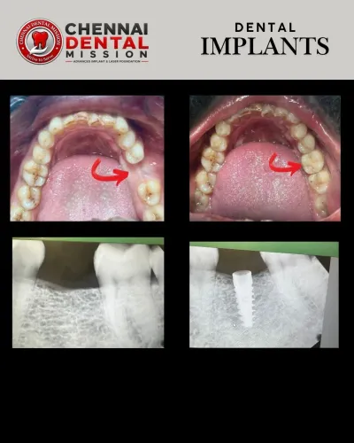 update image