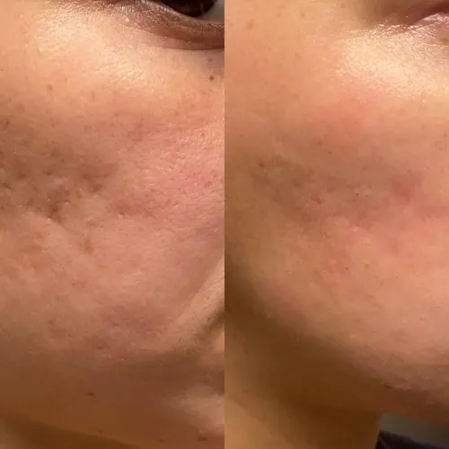 update image