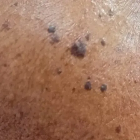 Vibha skin, hair and laser cli