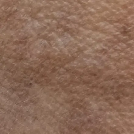 Vibha skin, hair and laser cli