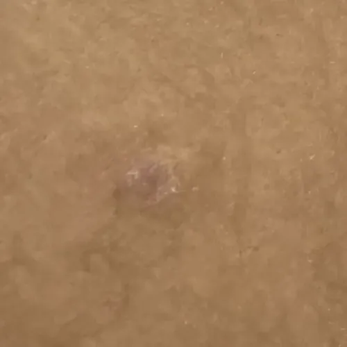 Dr.s.Valarmathi, the best derm