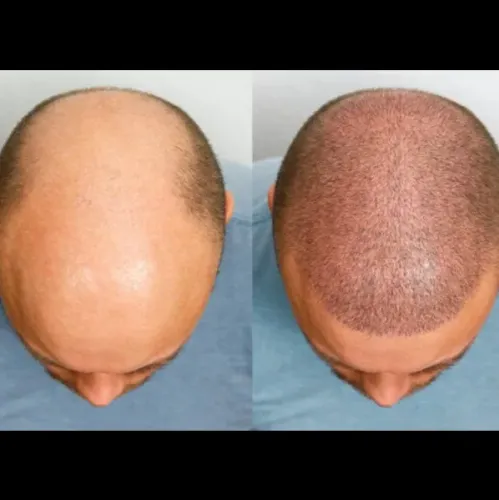 update image