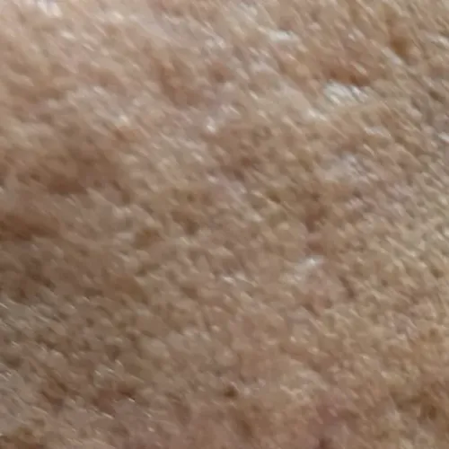 Vibha skin, hair and laser cli
