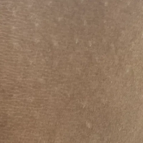 Dr.s.Valarmathi, a dermatologi