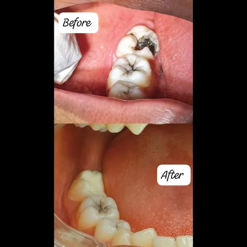 update image