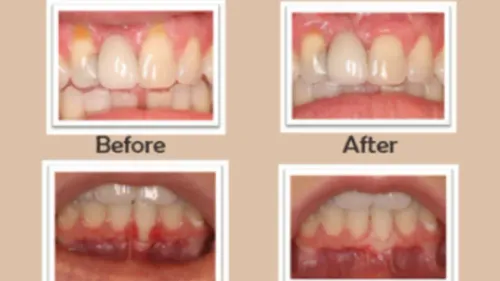 update image