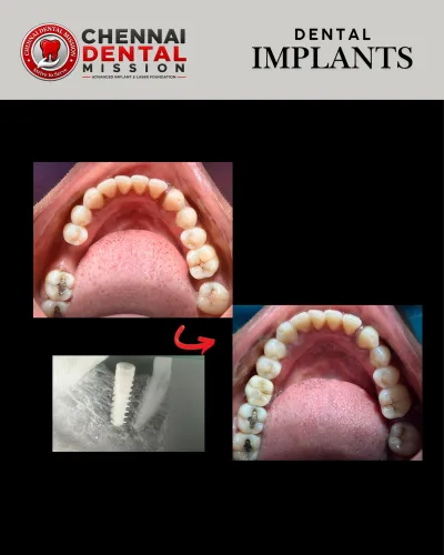 update image