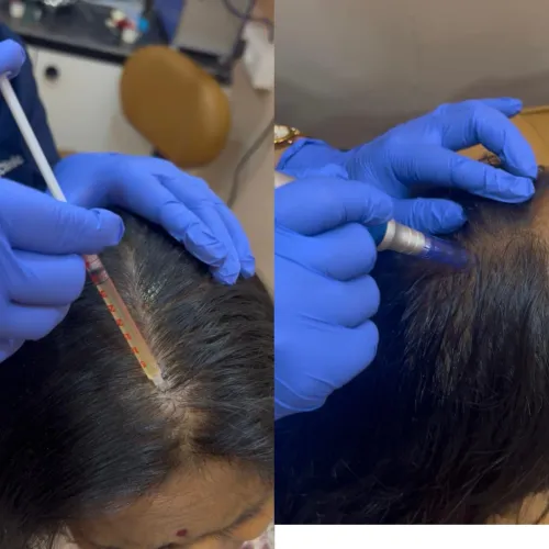 update image
