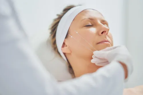 Dermal thread treatment is con