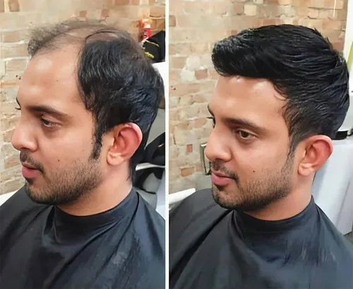 Front Lace Hair Patch in Rohin