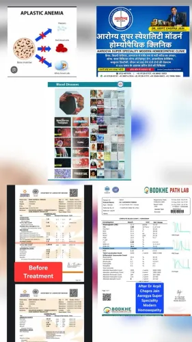 update image