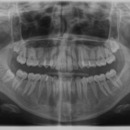 update image