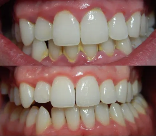 update image