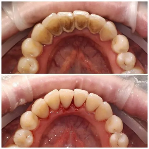 update image