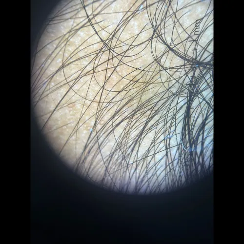 healthier fuller looking hair