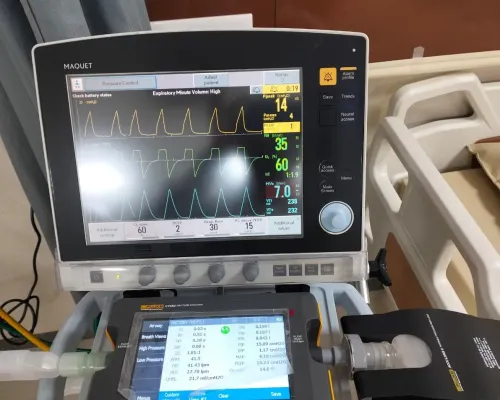 Calibration Of  Ventilaor