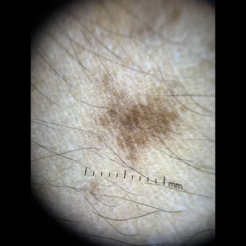 healthier fuller looking hair