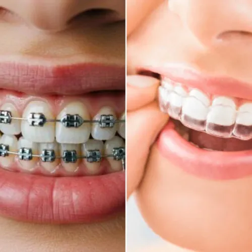 At Pearl Dentistry, we offer