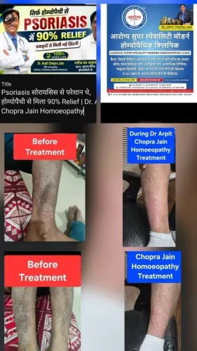 update image