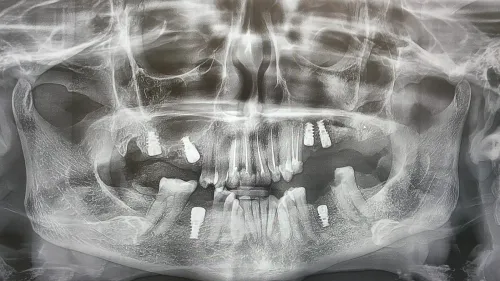 update image