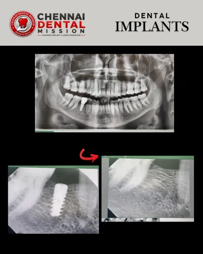 update image