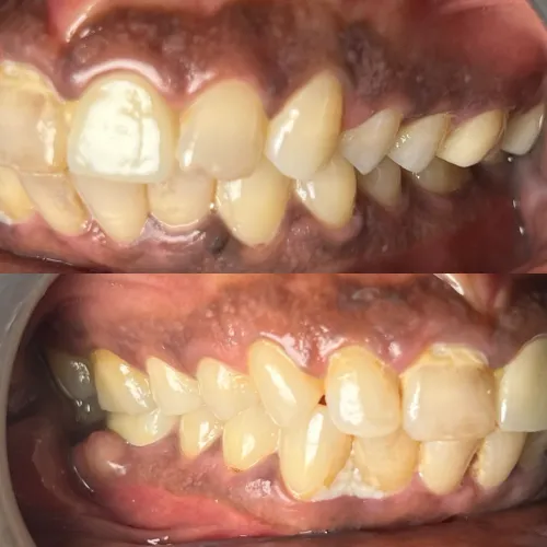 update image