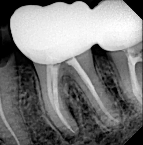 update image