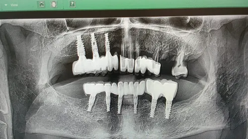 update image