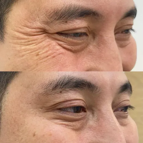 update image