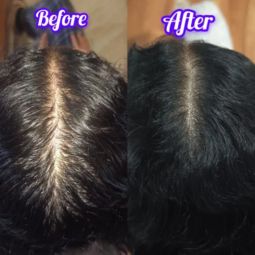 update image