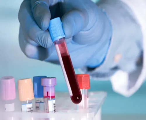 Pathology Lab Near me