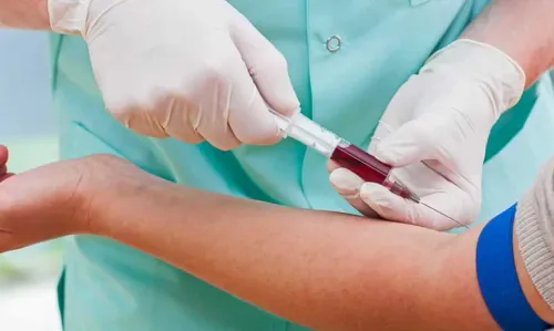 Blood Test Near Me