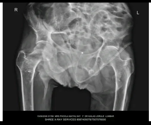 update image