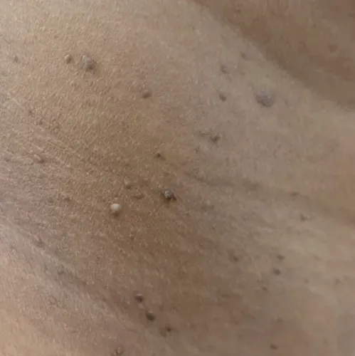 Vibha skin, hair and laser cli